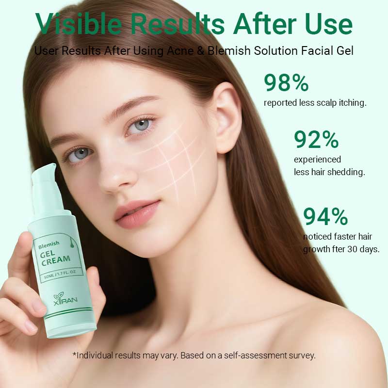 private label blemish solution facial gel